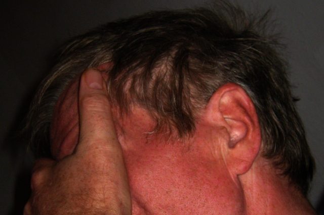 Невротические расстройства (реферат)